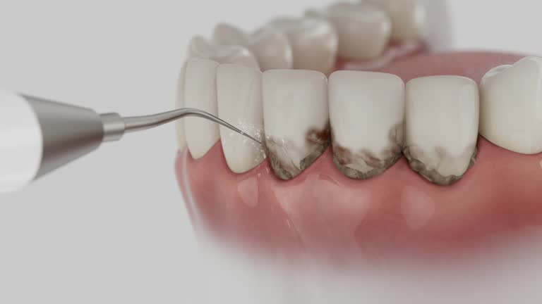 Reliable Teeth Cleaning And Checkup contractor in Hansford County County, TX by Dentist Open Now